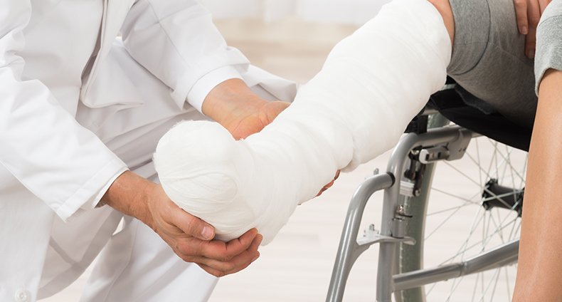 Broken Bones Broken Bones