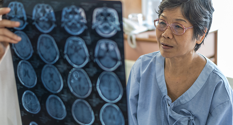 L Stroke Treatment L Stroke Treatment