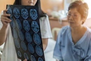 Study Shows Acute Stroke Patients Are Waiting for Care